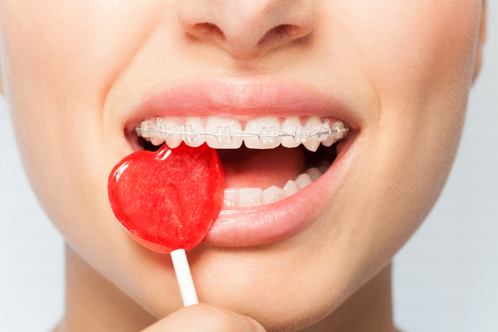 What candies can you eat with braces?