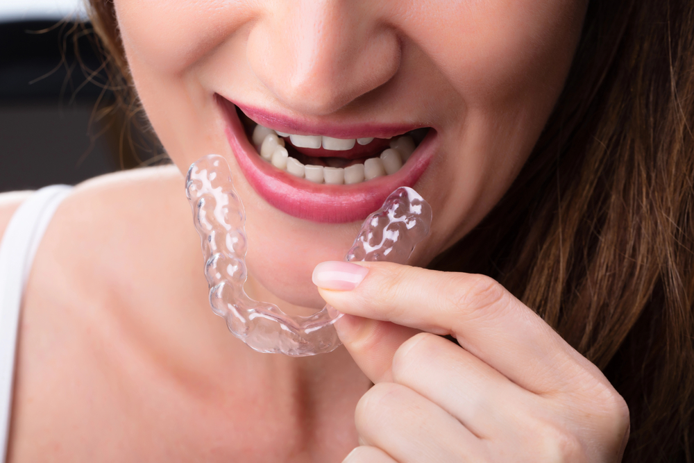 Can Invisalign fix an underbite?