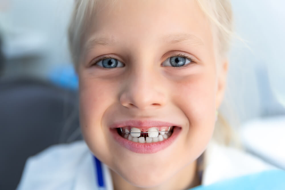 Child wondering how long do braces take to close a gap?