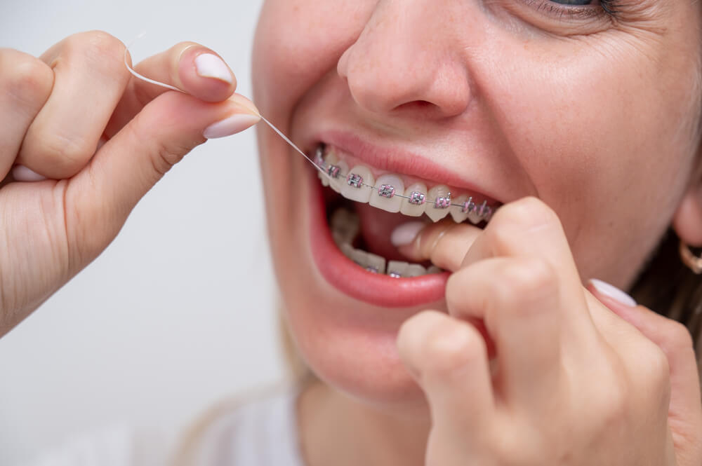 How do I take care of braces?