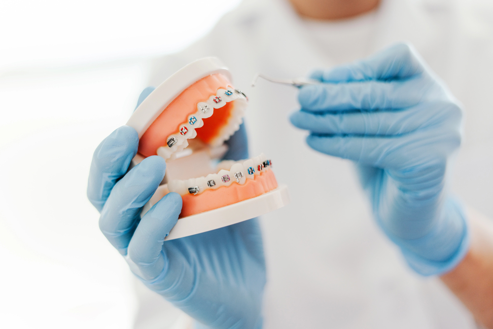 The type of orthodontic treatment you need determines how much it will cost.