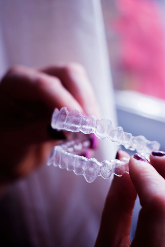 A closeup of two hands holding two Invisalign aligners.
