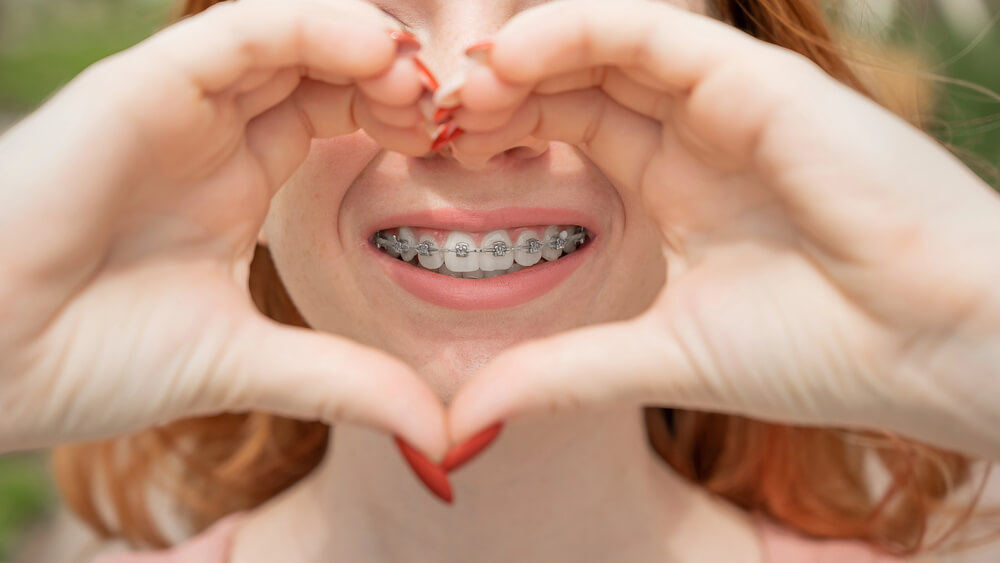 How long do you have to wear braces? Here's a guide.