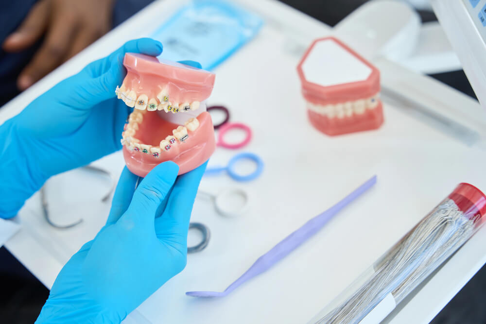 How long do you have to wear braces? There are 3 categories braces treatment fall into.