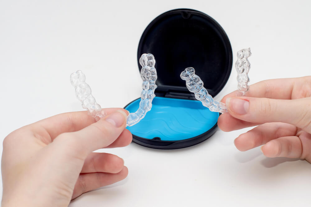 Invisalign cost can be helped with financing options.